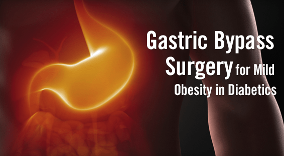 Changes After 7 Years of Roux-en-Y Gastric Bypass Surgery