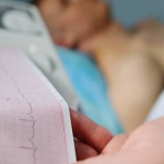 ECG